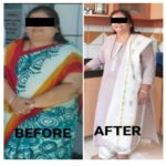 Jupiter-Hospital-Bariatric-Surgery-Before-and-After-5-.jpg