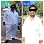 Jupiter-Hospital-Bariatric-Surgery-Before-and-After-photo-2-1.jpg